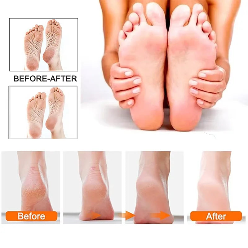 Rechargeable Electric Foot File /1+10 Set including Callus Remover,  Machine Pedicure Device,  Foot Care Tools For Heels, Remove Dead Skin .black