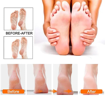 Rechargeable Electric Foot File /1+10 Set including Callus Remover,  Machine Pedicure Device,  Foot Care Tools For Heels, Remove Dead Skin .black